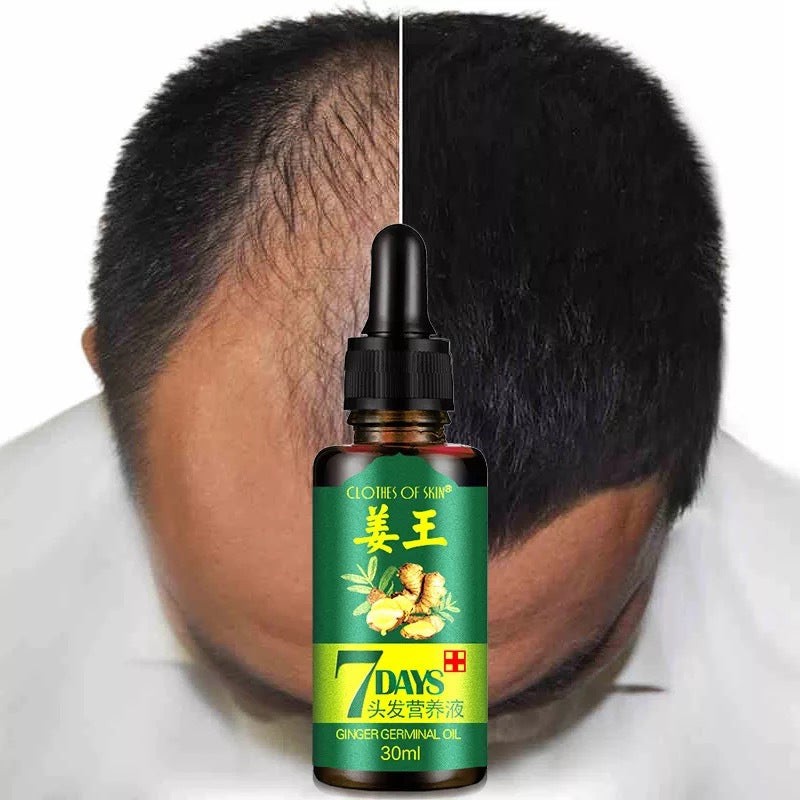 Factory direct skin clothing ginger king hair nutrition liquid spot ginger Wang Sheng liquid can be authorized spot genuine